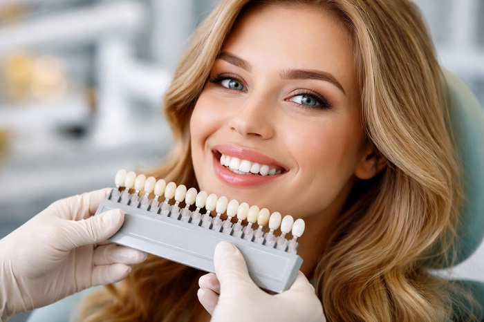 Smile Makeover Porcelain Veneers | Shade Selection Guide