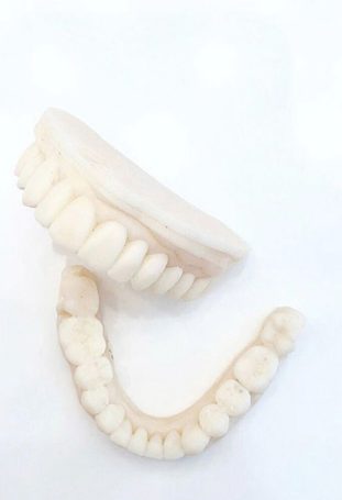 Veneers Sydney