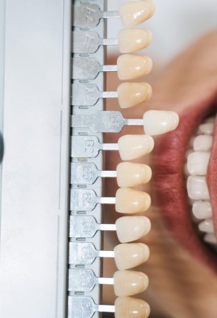 Oral Care Routine